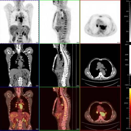 Abdomen y pelvis