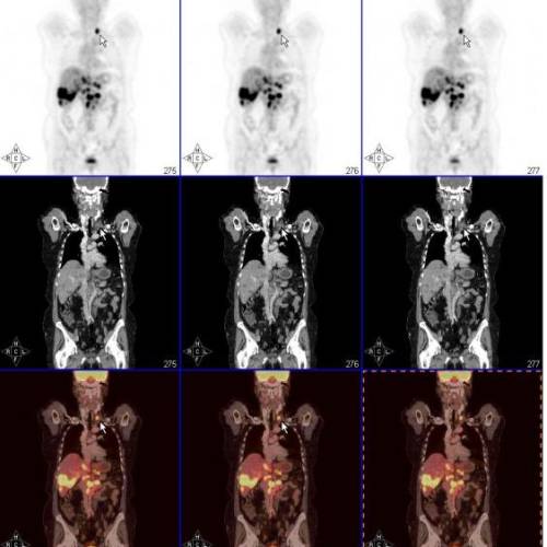 Abdomen y pelvis