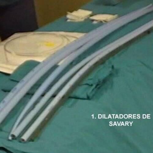 Dilatación Esofágica con Savary