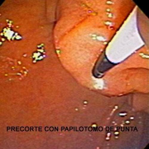 Precorte