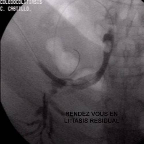 Rendez Vous
