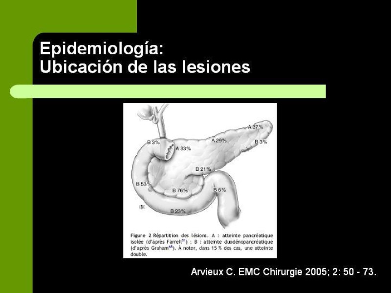 Diapositiva 5 de Trauma Pancreato-Duodenal