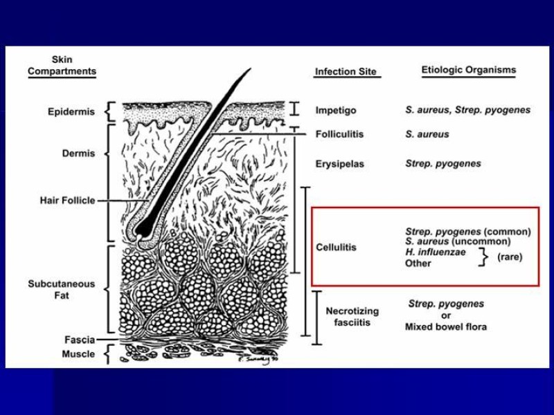 Diapositiva 8 de Celulitis, Erisipela y Loxoscelismo