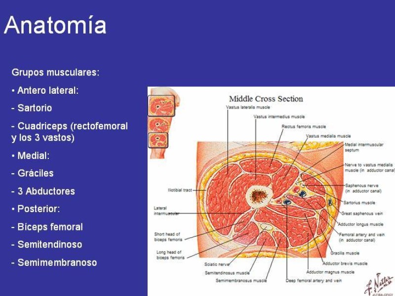 Diapositiva 3 de Desarticulación de rodilla y amputación supracondilea