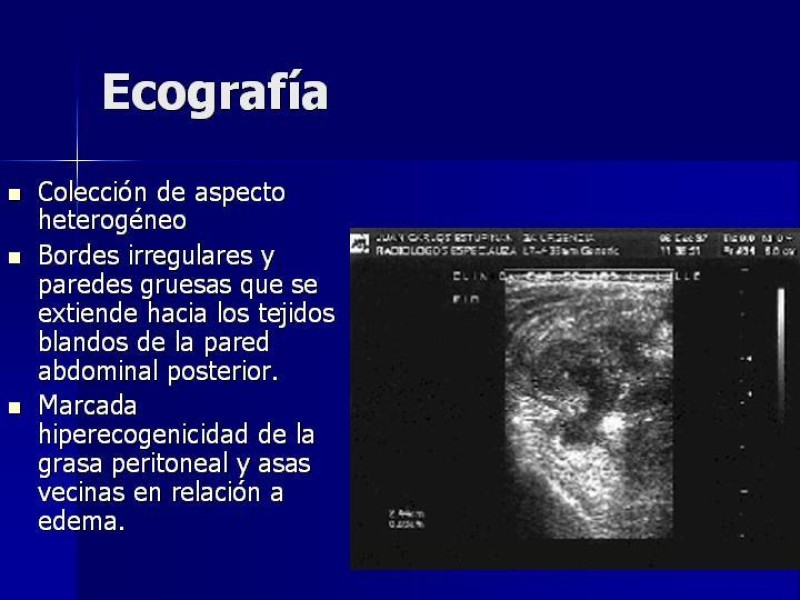 Diapositiva 5 de Plastrón Apendicular