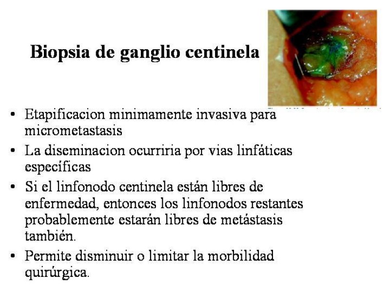 Diapositiva 19 de Manejo del Melanoma