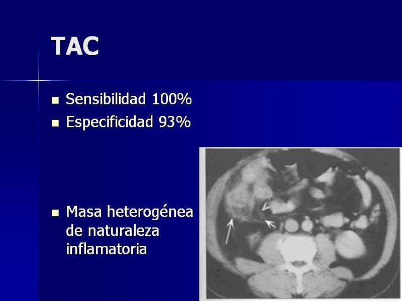 Diapositiva 6 de Plastrón Apendicular