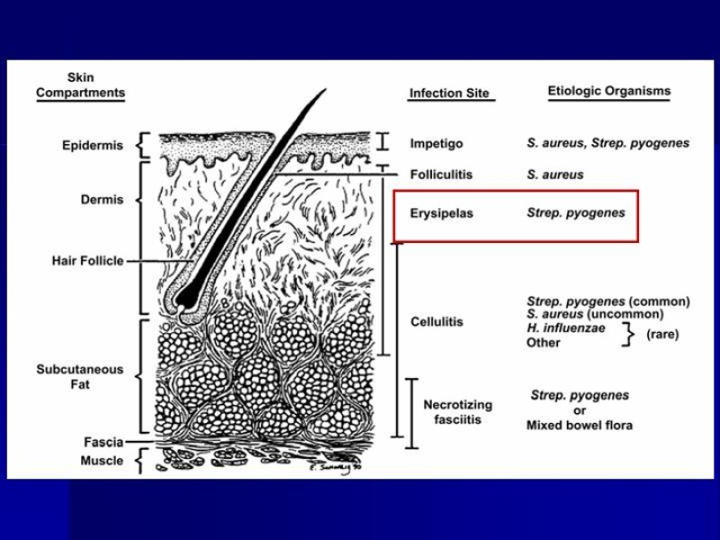 Diapositiva 2 de Celulitis, Erisipela y Loxoscelismo