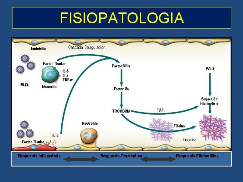 Diapositiva 21 de Sepsis