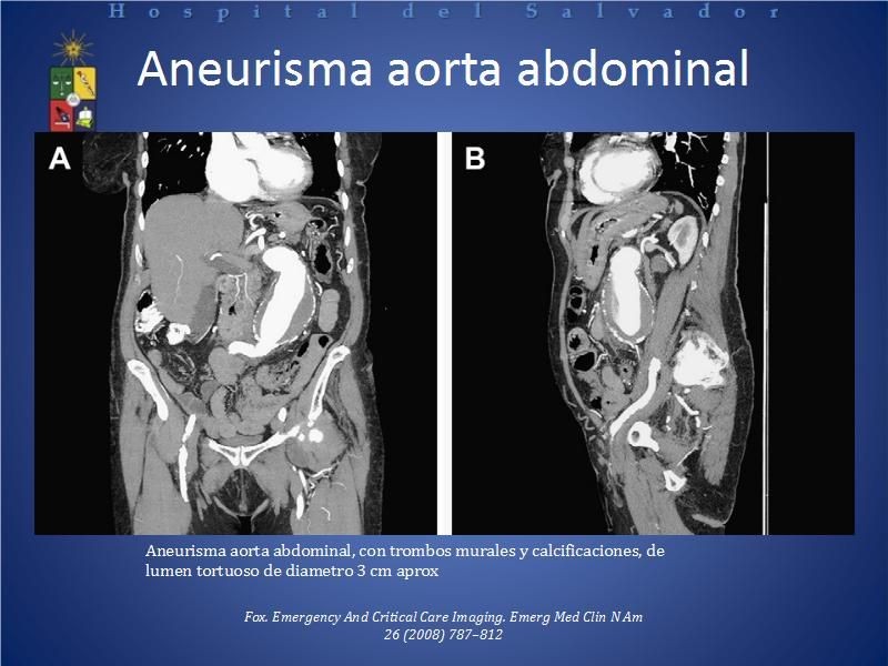 Diapositiva 28 de El rol del TAC de abdomen en Urgencia