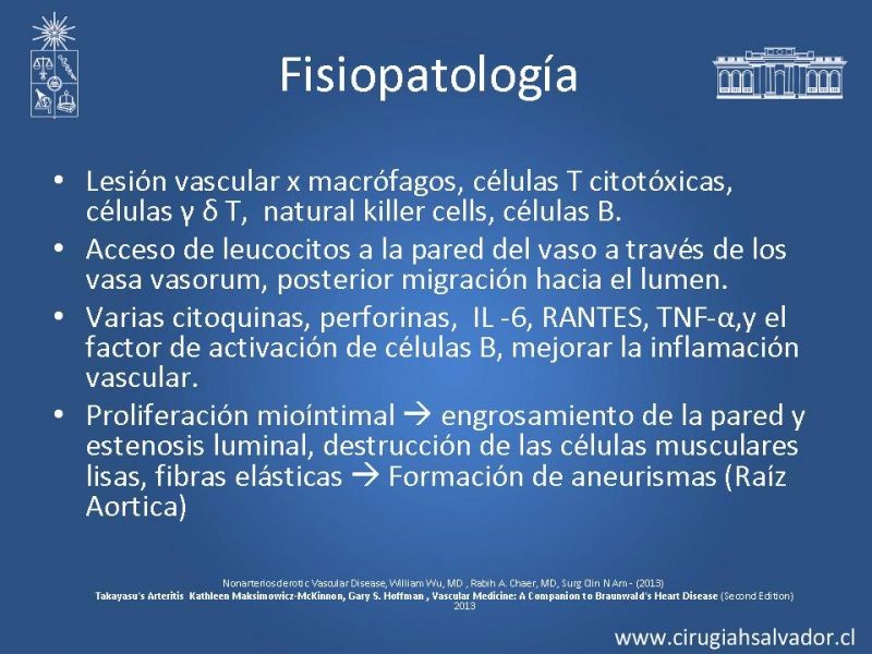 Diapositiva 17 de Enfermedad vascular no aterosclerótica: Diagnostico y manejo