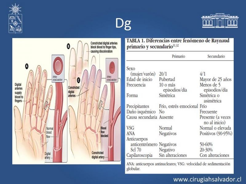 Diapositiva 38 de Enfermedad vascular no aterosclerótica: Diagnostico y manejo