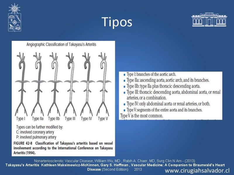 Diapositiva 19 de Enfermedad vascular no aterosclerótica: Diagnostico y manejo