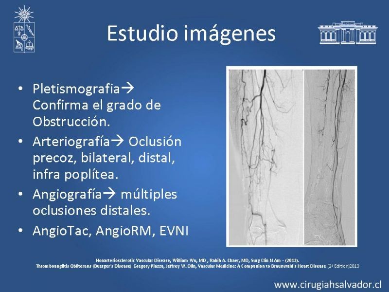 Diapositiva 7 de Enfermedad vascular no aterosclerótica: Diagnostico y manejo