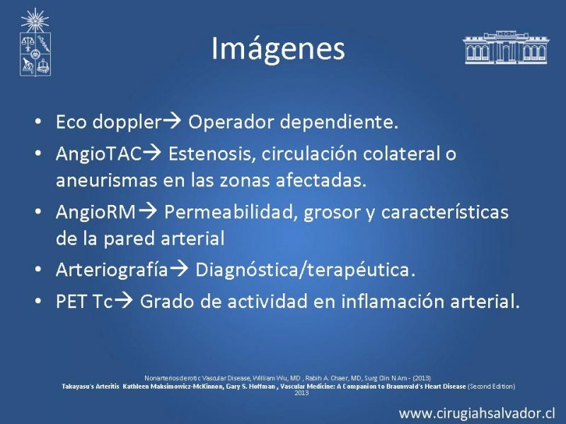 Diapositiva 21 de Enfermedad vascular no aterosclerótica: Diagnostico y manejo