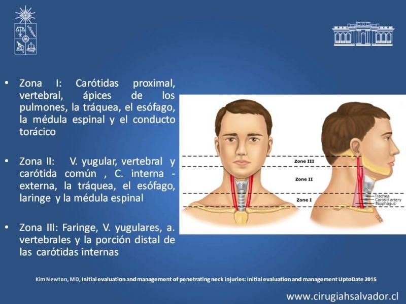 Diapositiva 5 de Trauma Penetrante Cervical