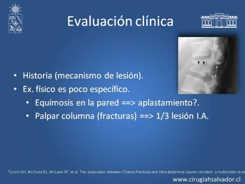 Diapositiva 5 de Trauma Pancreatoduodenal