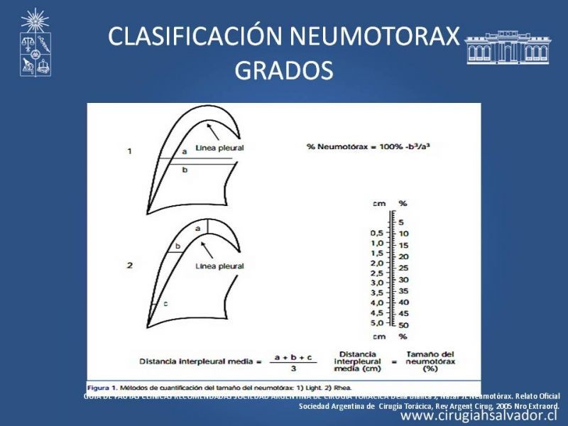 Diapositiva 21 de Trauma Torax I