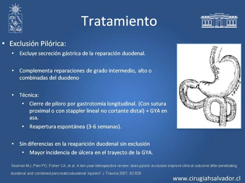 Diapositiva 21 de Trauma Pancreatoduodenal