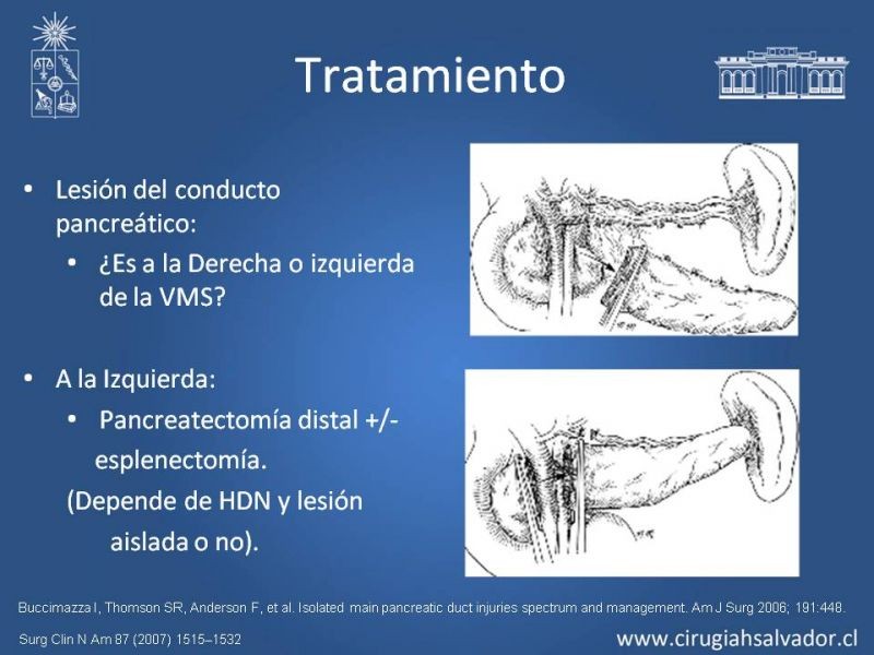 Diapositiva 26 de Trauma Pancreatoduodenal