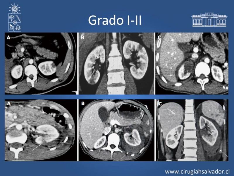 Diapositiva 8 de Trauma Renal