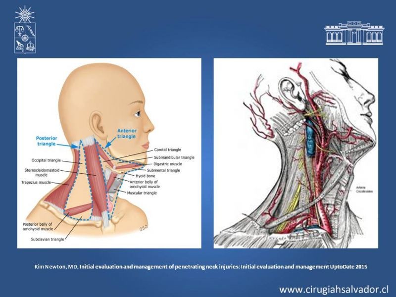 Diapositiva 6 de Trauma Penetrante Cervical