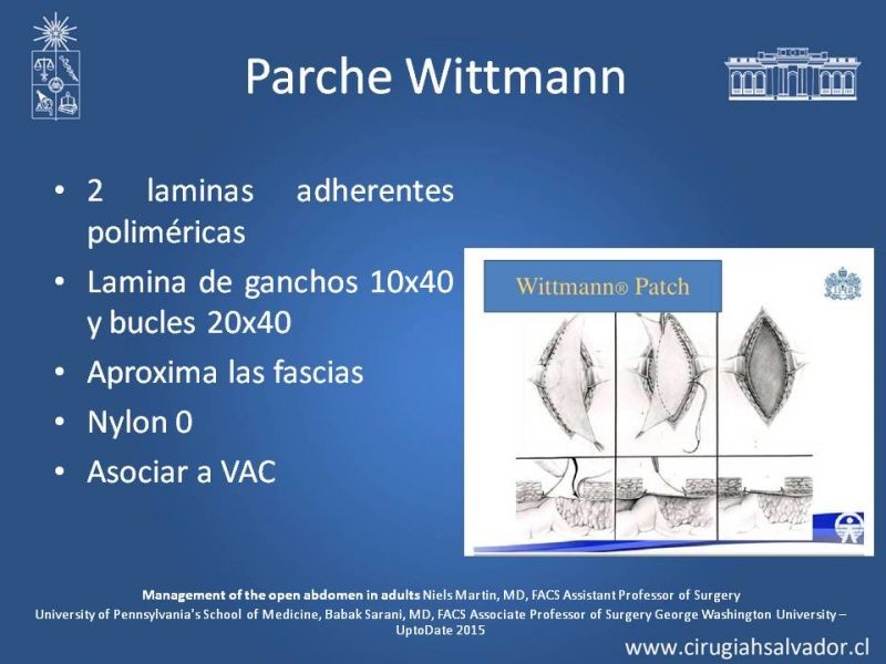 Diapositiva 7 de Laparostomía contenida