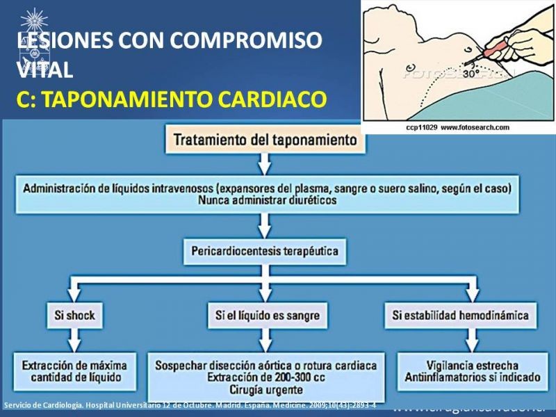 Diapositiva 37 de Trauma Torax I