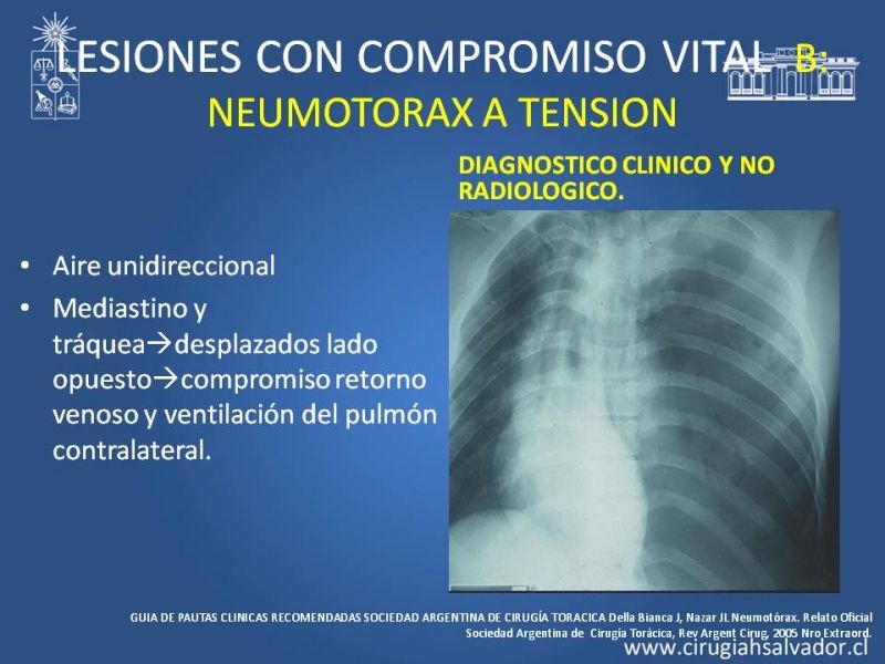 Diapositiva 18 de Trauma Torax I