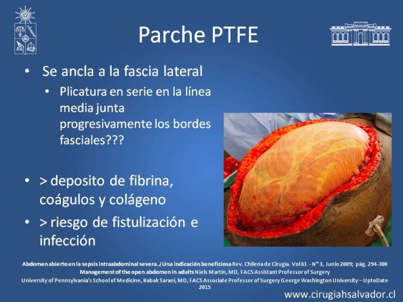 Diapositiva 8 de Laparostomía contenida