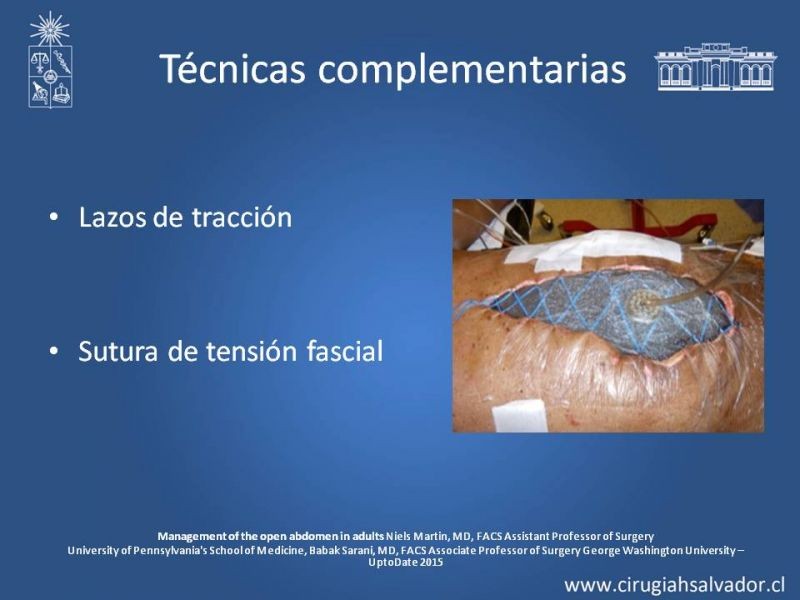 Diapositiva 12 de Laparostomía contenida