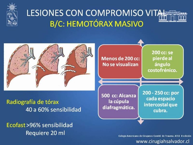 Diapositiva 28 de Trauma Torax I