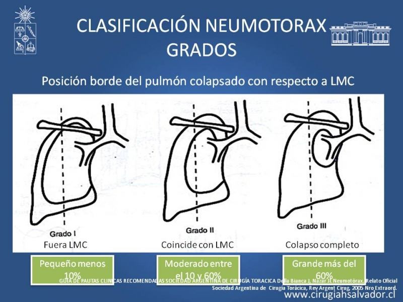 Diapositiva 20 de Trauma Torax I