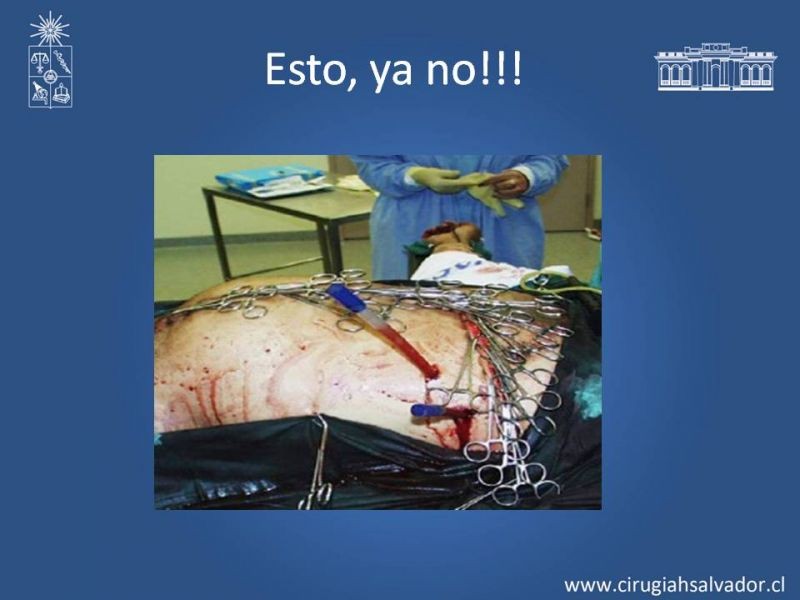 Diapositiva 5 de Laparostomía contenida