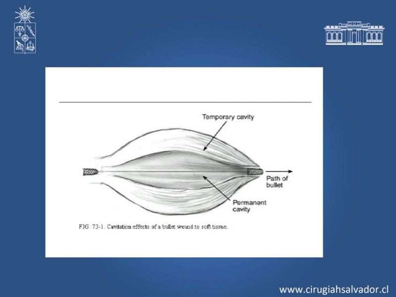 Diapositiva 9 de Trauma Penetrante Cervical