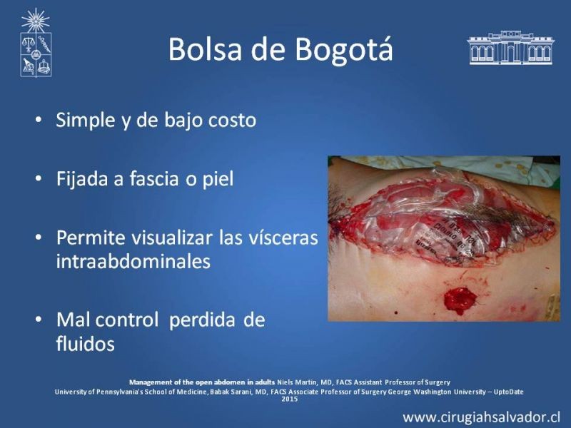 Diapositiva 11 de Laparostomía contenida