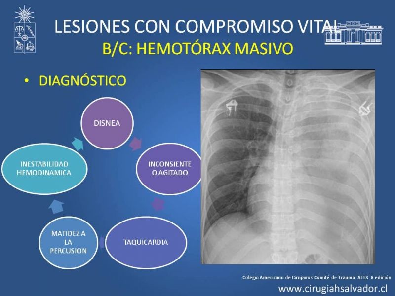 Diapositiva 27 de Trauma Torax I