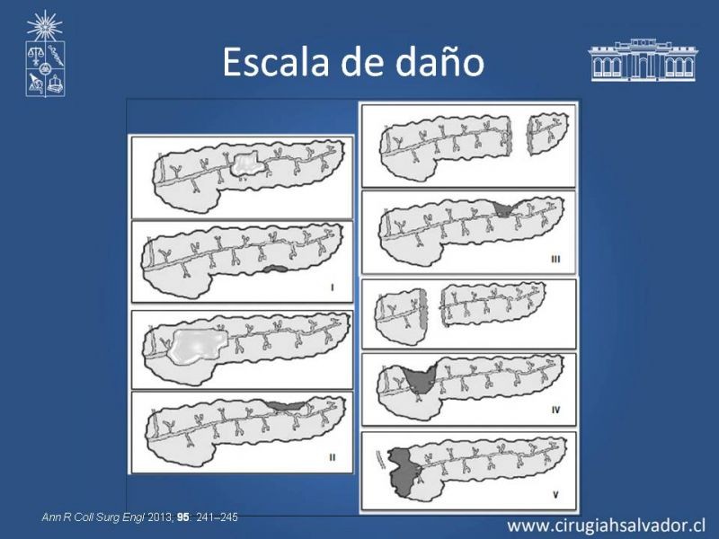 Diapositiva 11 de Trauma Pancreatoduodenal