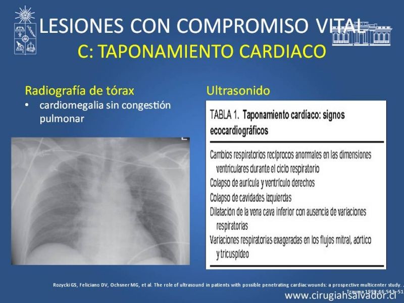 Diapositiva 36 de Trauma Torax I