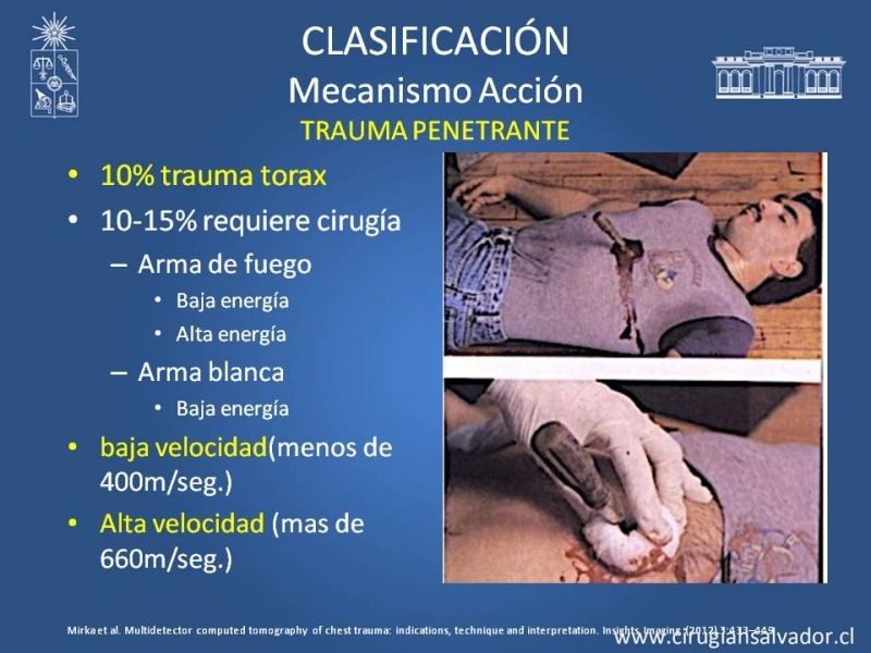 Diapositiva 11 de Trauma Torax I