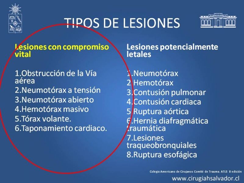 Diapositiva 13 de Trauma Torax I