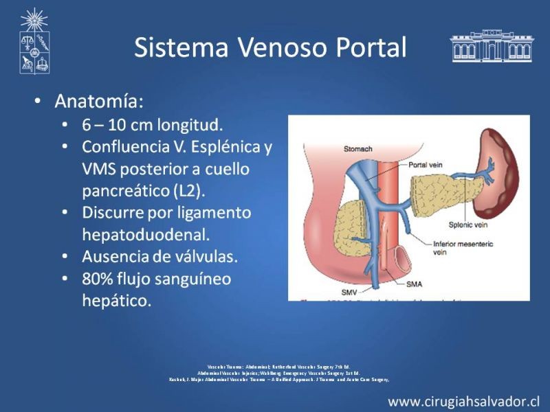 Diapositiva 54 de Trauma Vascular Abdominal