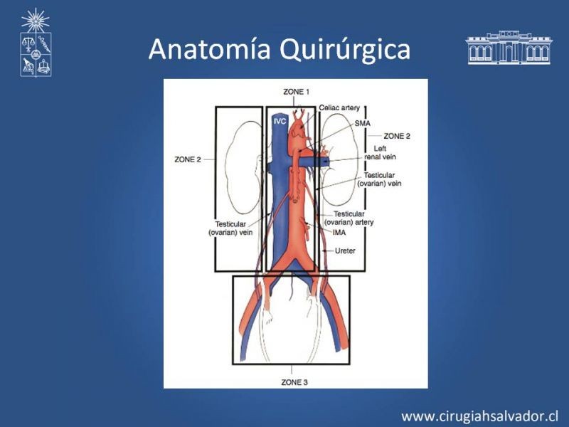 Diapositiva 3 de Trauma Vascular Abdominal