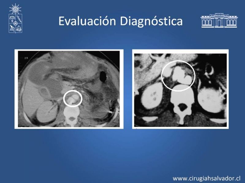 Diapositiva 9 de Trauma Vascular Abdominal