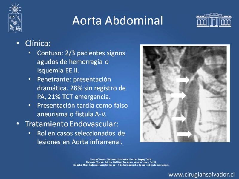 Diapositiva 27 de Trauma Vascular Abdominal