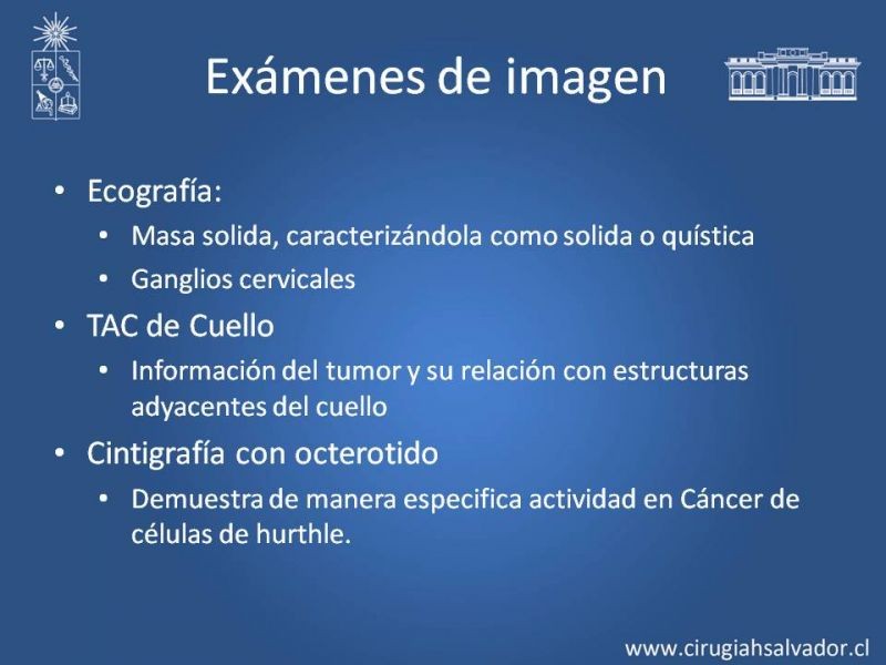 Diapositiva 10 de Tumor Celulas de Hurthle