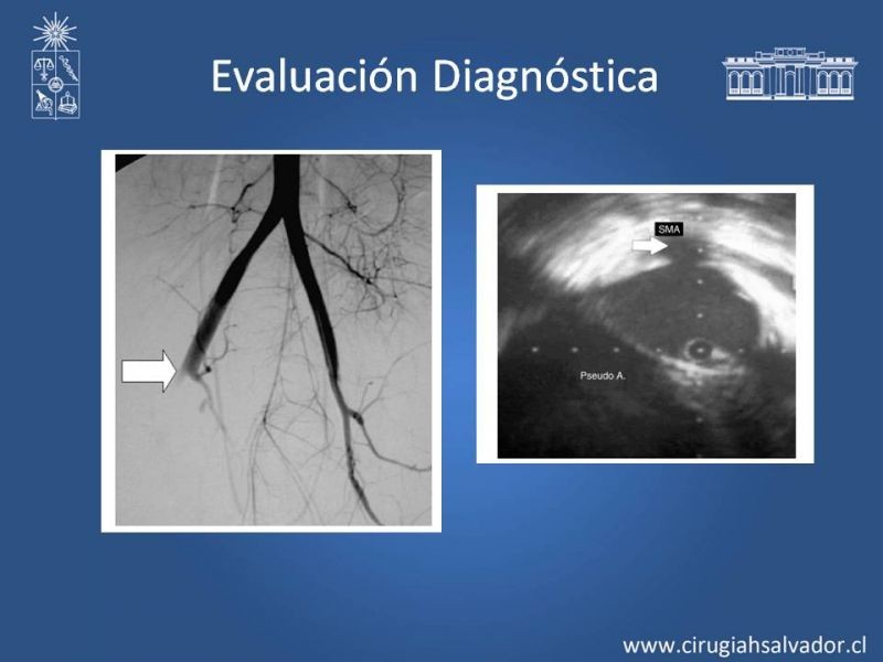 Diapositiva 10 de Trauma Vascular Abdominal
