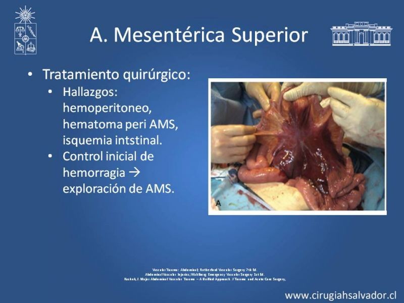 Diapositiva 35 de Trauma Vascular Abdominal