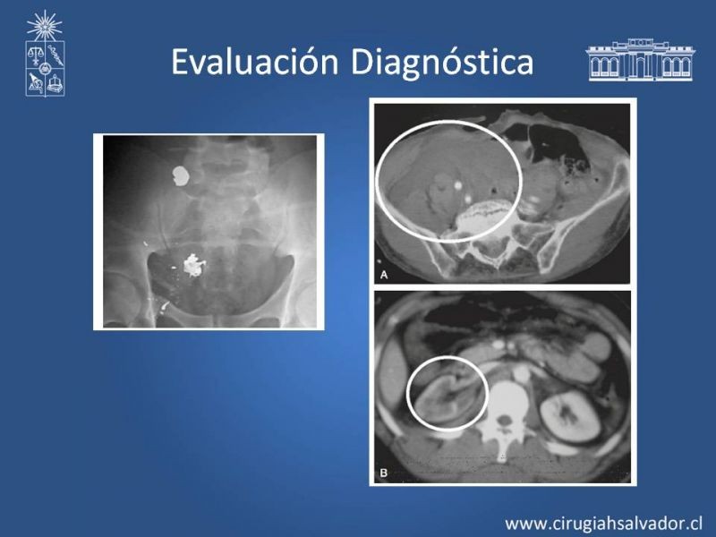 Diapositiva 8 de Trauma Vascular Abdominal