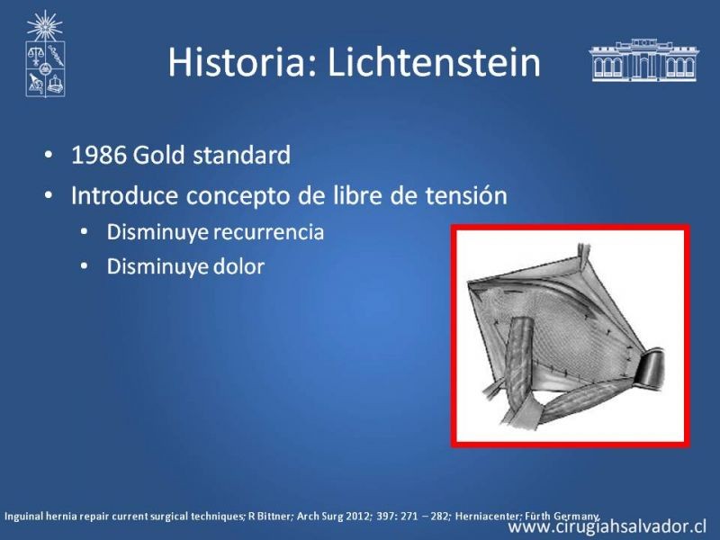 Diapositiva 4 de Hernioplastía Inguinal (Laparoscópica vs Abierta)